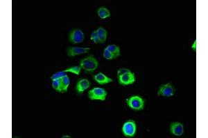 Immunofluorescent analysis of MCF-7 cells using ABIN7151123 at dilution of 1:100 and Alexa Fluor 488-congugated AffiniPure Goat Anti-Rabbit IgG(H+L)