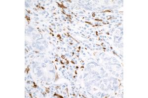 Immunohistochemistry (IHC) image for anti-CD163 (CD163) (AA 850-900) antibody (ABIN7448890)