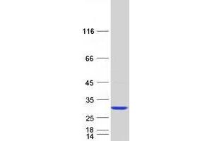 Validation with Western Blot