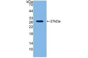 Detection of Recombinant LOXL1, Mouse using Polyclonal Antibody to Lysyl Oxidase Like Protein 1 (LOXL1)