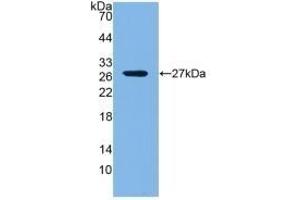 Detection of Recombinant LOXL1, Mouse using Polyclonal Antibody to Lysyl Oxidase Like Protein 1 (LOXL1) (LOXL1 anticorps  (AA 392-598))