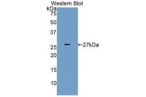 Detection of Recombinant CDK5, Human using Monoclonal Antibody to Cyclin Dependent Kinase 5 (CDK5) (CDK5 anticorps  (AA 92-273))