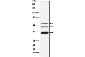 Western blot analysis of Legumain expression in HeLa cell lysate.
