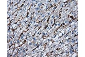 Immunohistochemical staining of paraffin-embedded liver tissue using anti-CD36mouse monoclonal antibody. (CD36 anticorps)