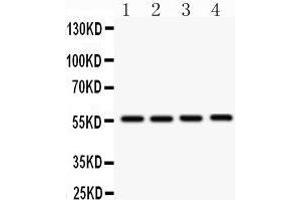 Anti- SMAD3 Picoband antibody, Western blotting All lanes: Anti SMAD3  at 0. (SMAD3 anticorps  (Middle Region))