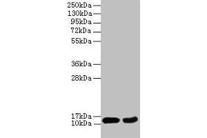 Western blot All lanes: EIF4EBP2 antibody at 2 μg/mL Lane 1: Mouse heart tissue Lane 2: NIH/3T3 whole cell lysate Secondary Goat polyclonal to rabbit IgG at 1/10000 dilution Predicted band size: 13 kDa Observed band size: 13 kDa (eIF4EBP2 anticorps  (AA 1-120))
