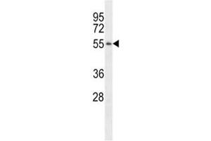 Western blot analysis of TSPY antibody pre-incubated without (Lane 1) and with (2) blocking peptide in LNCAP lysate.
