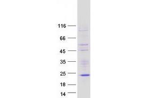 Validation with Western Blot (NK6 Homeobox 3 Protein (NKX6-3) (Myc-DYKDDDDK Tag))