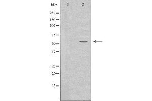 Western blot analysis of extracts from Jurkat cells, using Cytochrome P450 2A6 antibody. (CYP2A6 anticorps  (N-Term))