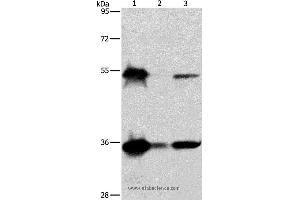 Western blot analysis of Hela, K562 and Raji cell, using BAG1 Polyclonal Antibody at dilution of 1:750