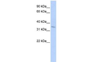 WB Suggested Anti-TNFRSF25 Antibody Titration:  0. (DR3/LARD anticorps  (Middle Region))