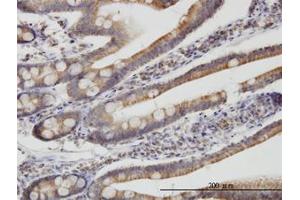 Image no. 1 for anti-Translocase of Inner Mitochondrial Membrane 9 (TIMM9) (AA 1-90) antibody (ABIN599211) (TIMM9 anticorps  (AA 1-90))