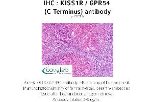 Image no. 1 for anti-KISS1 Receptor (KISS1R) (C-Term) antibody (ABIN1736238) (KISS1R anticorps  (C-Term))