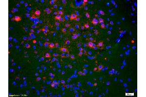 Formalin-fixed and paraffin-embedded rat brain labeled with Anti-ACTH (1-39) Polyclonal Antibody, Unconjugated (ABIN668676) 1:200, overnight at 4°C, The secondary antibody was Goat Anti-Rabbit IgG, Cy3 conjugated used at 1:200 dilution for 40 minutes at 37°C. (ACTH anticorps  (AA 1-39))