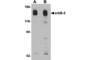 Western Blotting (WB) image for anti-Receptor tyrosine-protein kinase erbB-2 (ErbB2/Her2) (C-Term) antibody (ABIN1030383) (ErbB2/Her2 anticorps  (C-Term))