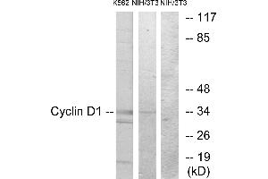 Western blot analysis of extracts from K562 cells and NIH-3T3 cells, using Cyclin D1 (Ab-90) antibody.