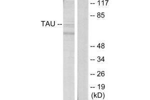 Western blot analysis of extracts from HeLa cells, using Tau (Ab-396) antibody.