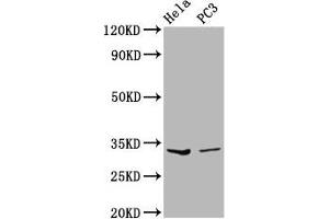 Western Blot Positive WB detected in: Hela whole cell lysate, PC-3 whole cell lysate All lanes: RNASEH1 antibody at 3. (Ribonuclease H1 anticorps  (AA 73-185))