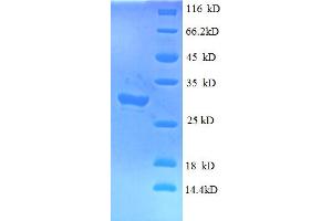 SDS-PAGE (SDS) image for Interferon-Induced Transmembrane Protein 1 (IFITM1) (AA 1-36), (Extracellular) protein (GST tag) (ABIN5712123)