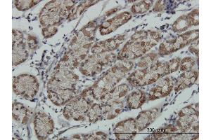 Immunoperoxidase of monoclonal antibody to RPS6KA6 on formalin-fixed paraffin-embedded human stomach. (RPS6KA6 anticorps  (AA 636-745))