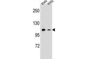 Western Blotting (WB) image for anti-Integrin alpha M (ITGAM) antibody (ABIN2995765) (CD11b anticorps)