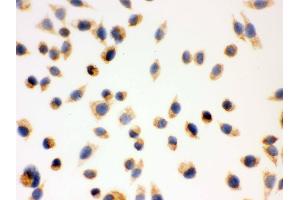 IHC analysis of ERAB using anti-ERAB antibody .