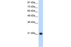 WB Suggested Anti-RPL9 Antibody Titration:  1. (RPL9 anticorps  (C-Term))