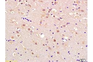 Formalin-fixed and paraffin embedded rat brain labeled with Anti-APEX2 Polyclonal Antibody, Unconjugated (ABIN718481) at 1:200 followed by conjugation to the secondary antibody and DAB staining (APEX2 anticorps  (AA 301-400))