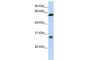 WB Suggested Anti-ACD Antibody Titration: 0. (ACD anticorps  (C-Term))