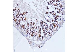 Immunohistochemistry of paraffin-embedded rat testis using P antibody (ABIN7269446) at dilution of 1:100 (40x lens). (PABP anticorps  (AA 350-450))