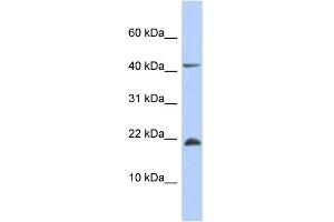 WB Suggested Anti-SFRS12IP1 Antibody Titration: 0. (SFRS12IP1 anticorps  (Middle Region))