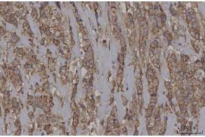 IHC analysis of STON1 using anti-STON1 antibody (ABIN7599896). (STON1 anticorps  (AA 127-688))