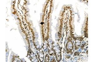 Phospho-RSK2 (Ser386) Antibody at 1/100 staining Rat colorectal tissue by IHC-P.