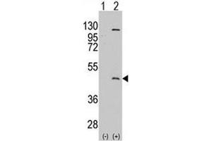 Western blot analysis of PRMT8 antibody and 293 cell lysate either nontransfected (Lane 1) or transiently transfected with the PRMT8 gene (2).