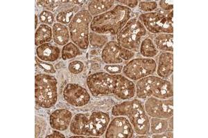 Immunohistochemical staining of human kidney with FAM180B polyclonal antibody  shows strong cytoplasmic positivity in tubular cells at 1:50-1:200 dilution. (FAM180B anticorps)