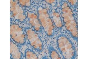 anti-Mediator Complex Subunit 1 (MED1) (AA 1-212) antibody