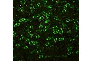 IF: SSH3BP1 antibody testing of rat brain tissue (ABI1 anticorps  (C-Term))