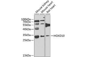 Western blot analysis of extracts of various cell lines, using HOXD10 antibody (ABIN6131767, ABIN6141956, ABIN6141957 and ABIN6223612) at 1:1000 dilution. (HOXD10 anticorps  (AA 1-240))