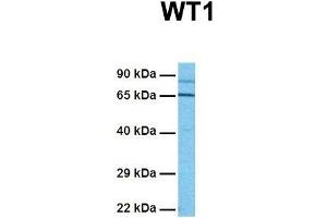 Host:  Rabbit  Target Name:  WT1  Sample Tissue:  Human Jurkat  Antibody Dilution:  1.