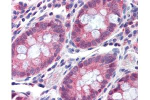 Anti-TMPRSS4 antibody IHC of human colon.