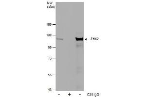 IP Image Immunoprecipitation of ZHX2 protein from MCF-7 whole cell extracts using 5 μg of ZHX2 antibody [C1C3], Western blot analysis was performed using ZHX2 antibody [C1C3], EasyBlot anti-Rabbit IgG  was used as a secondary reagent. (ZHX2 anticorps  (C-Term))