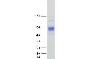 Validation with Western Blot