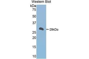 Detection of Recombinant a1BG, Mouse using Polyclonal Antibody to Alpha-1-B-Glycoprotein (a1BG) (A1BG anticorps  (AA 22-219))