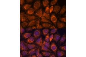 Immunofluorescence analysis of HeLa cells using MRPS14 antibody (ABIN7270013) at dilution of 1:100.