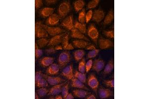 Immunofluorescence analysis of HeLa cells using MRPS14 antibody (ABIN7270013) at dilution of 1:100. (RPS14 anticorps  (AA 1-128))