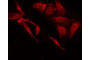ABIN6269309 staining HeLa by IF/ICC. (E2F1 anticorps  (C-Term))