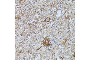 Immunohistochemistry of paraffin-embedded mouse spinal cord using FKBP1B antibody (ABIN7267212) at dilution of 1:100 (40x lens).