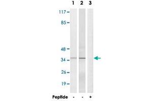 Western blot analysis of extracts from HepG2 cells (Lane 1) and Jurkat cells (Lane 2 and lane 3), using ELOVL1 polyclonal antibody . (ELOVL1 anticorps)