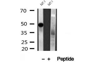Western blot analysis of extracts of BxPC-3 cells, using PADI2 antibody. (PADI2 anticorps  (Internal Region))