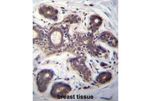 EIF2B1 Antibody (Center) immunohistochemistry analysis in formalin fixed and paraffin embedded human breast tissue followed by peroxidase conjugation of the secondary antibody and DAB staining. (EIF2B1 anticorps  (Middle Region))